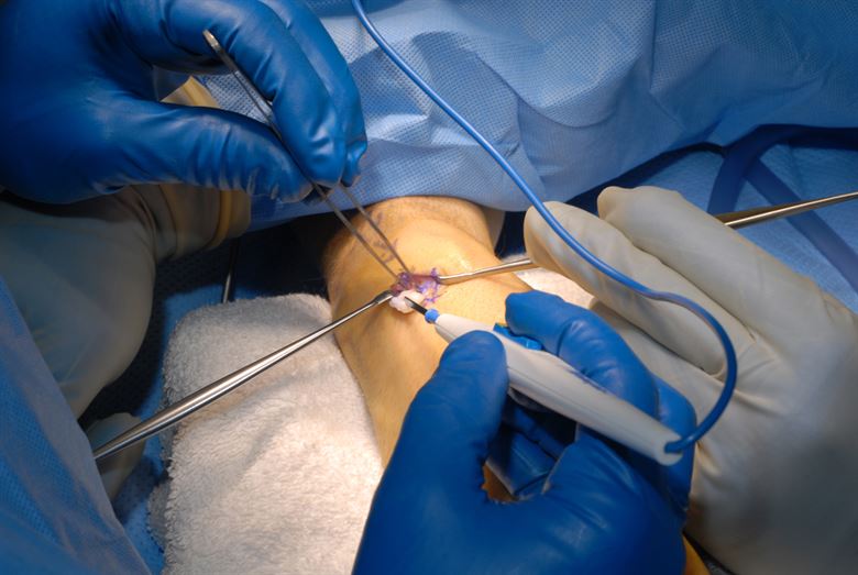 intervento-chirurgico