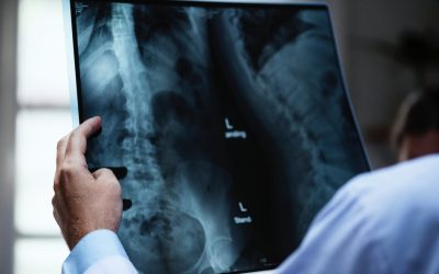 Risonanza e rx: utili per il tuo mal di schiena? Physiotherapy | Risonanza e rx: utili per il tuo mal di schiena?