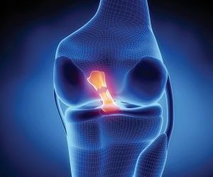 Lesione legamento crociato anteriore e ritorno allo sport Physiotherapy | Lesione legamento crociato anteriore e ritorno allo sport