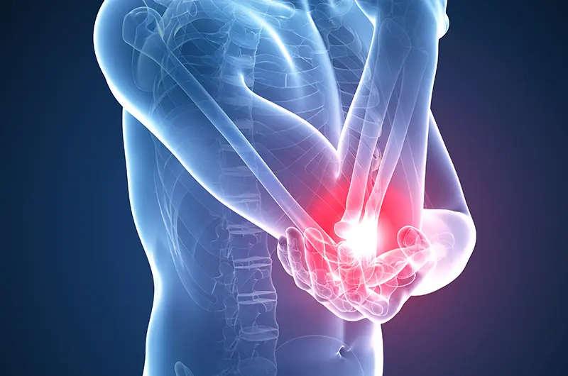 Physiotherapy | Il gomito del tennista