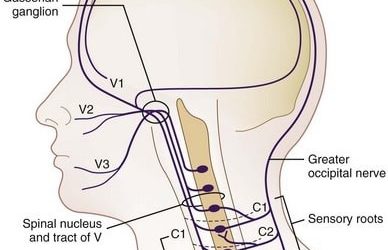 Emicrania Physiotherapy | Emicrania
