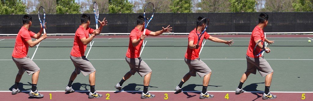 Physiotherapy | Tennis e lesione dell’estensore ulnare del carpo