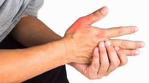Tenosinovite di De Quervain: cos'è, come si tratta Physiotherapy | Tenosinovite di De Quervain: cos'è, come si tratta