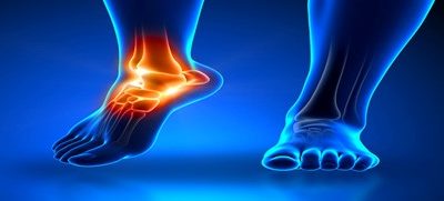 Distorsioni alla caviglia ed esercizio terapeutico Physiotherapy | Distorsioni alla caviglia ed esercizio terapeutico
