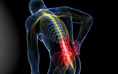 La sciatica infiammata: sintomi, cause e rimedi Physiotherapy | La sciatica infiammata: sintomi, cause e rimedi