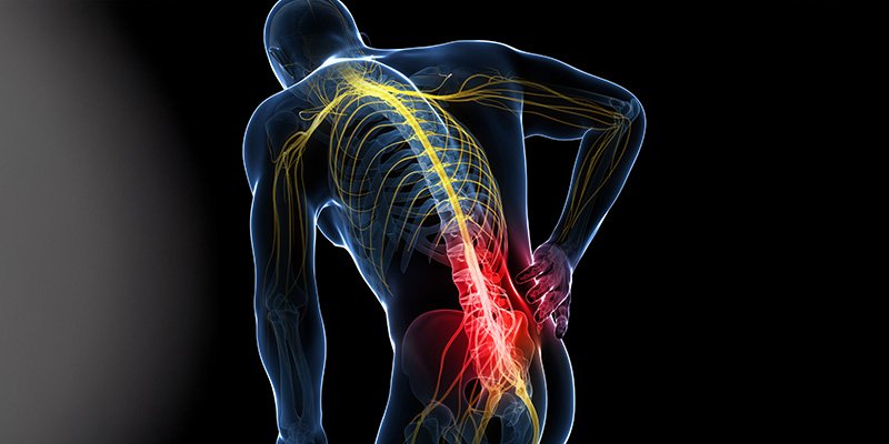 Physiotherapy | La sciatica infiammata: sintomi, cause e rimedi