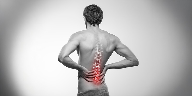 Sciatica infiammata sciatica-infiammata