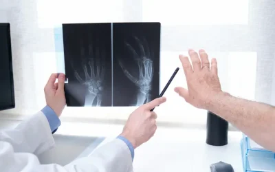 Artrosi delle mani Physiotherapy | Artrosi delle mani