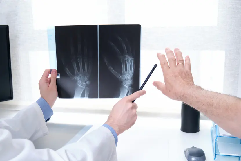 Physiotherapy | Artrosi delle mani