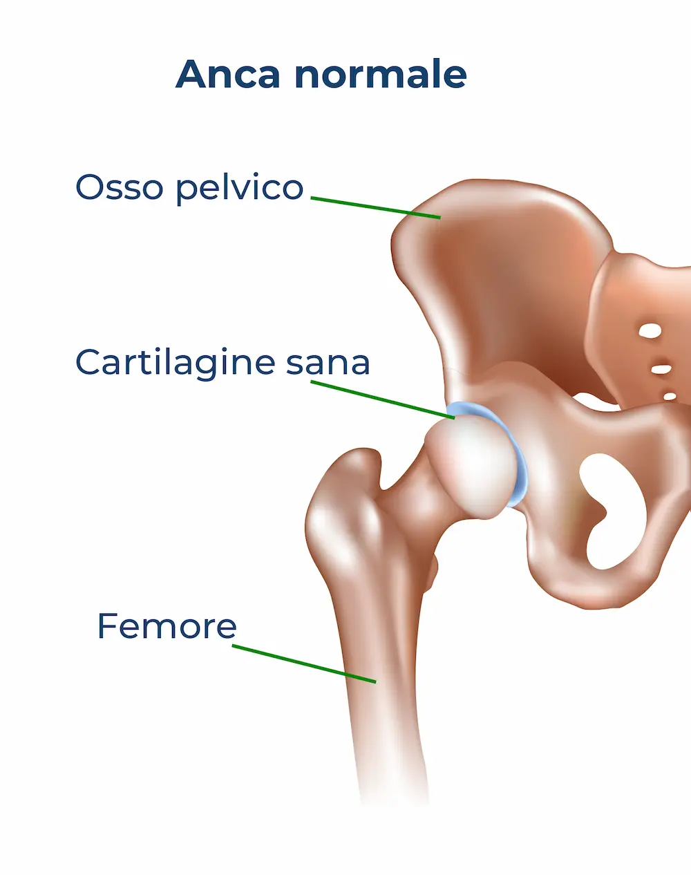 Artrosi dell'anca artrosi-anca-anatomia